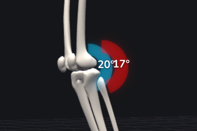 Live 3D skeleton with the left and right knee flexion arcs