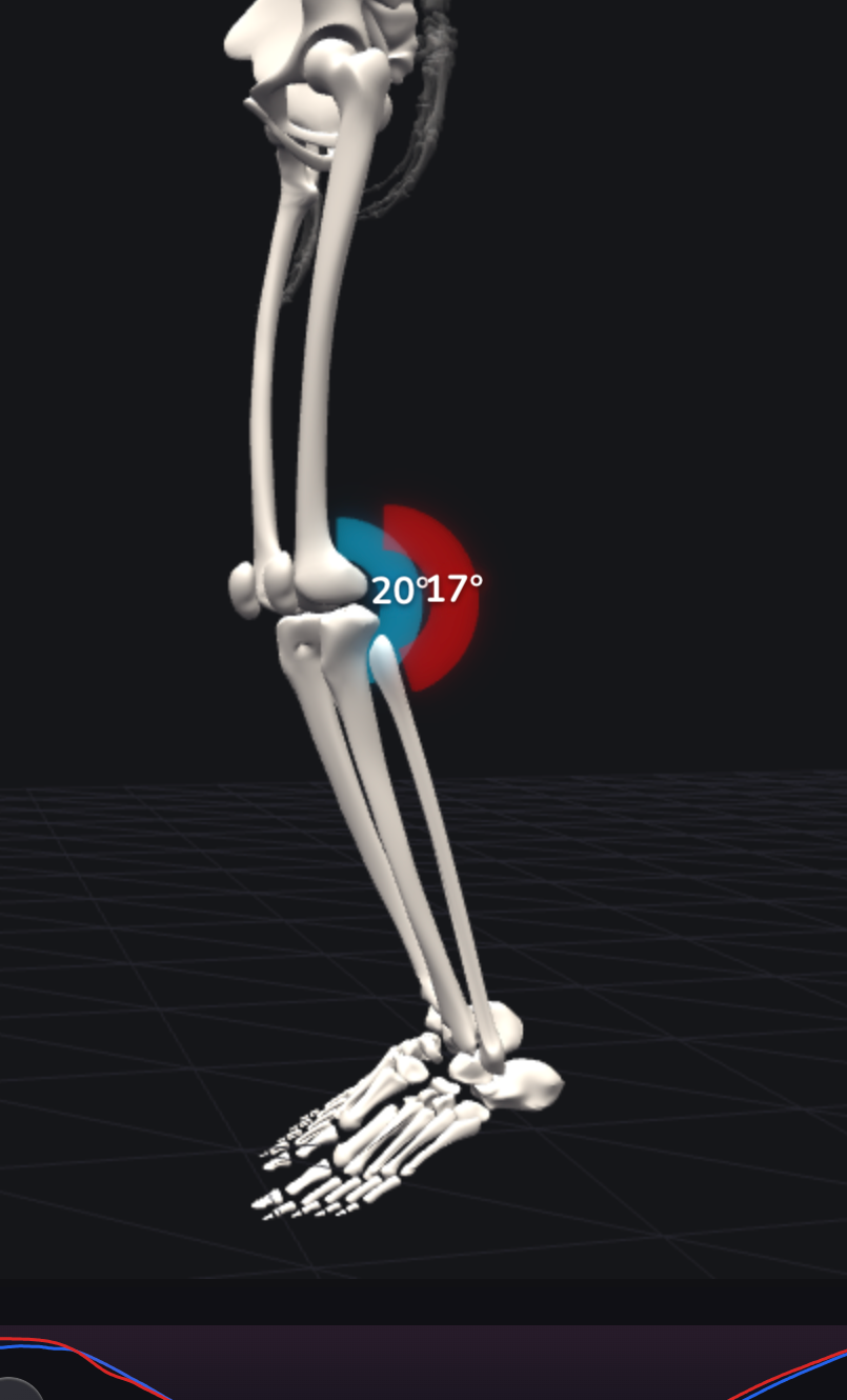 Live 3D skeleton with exact knee joint angles