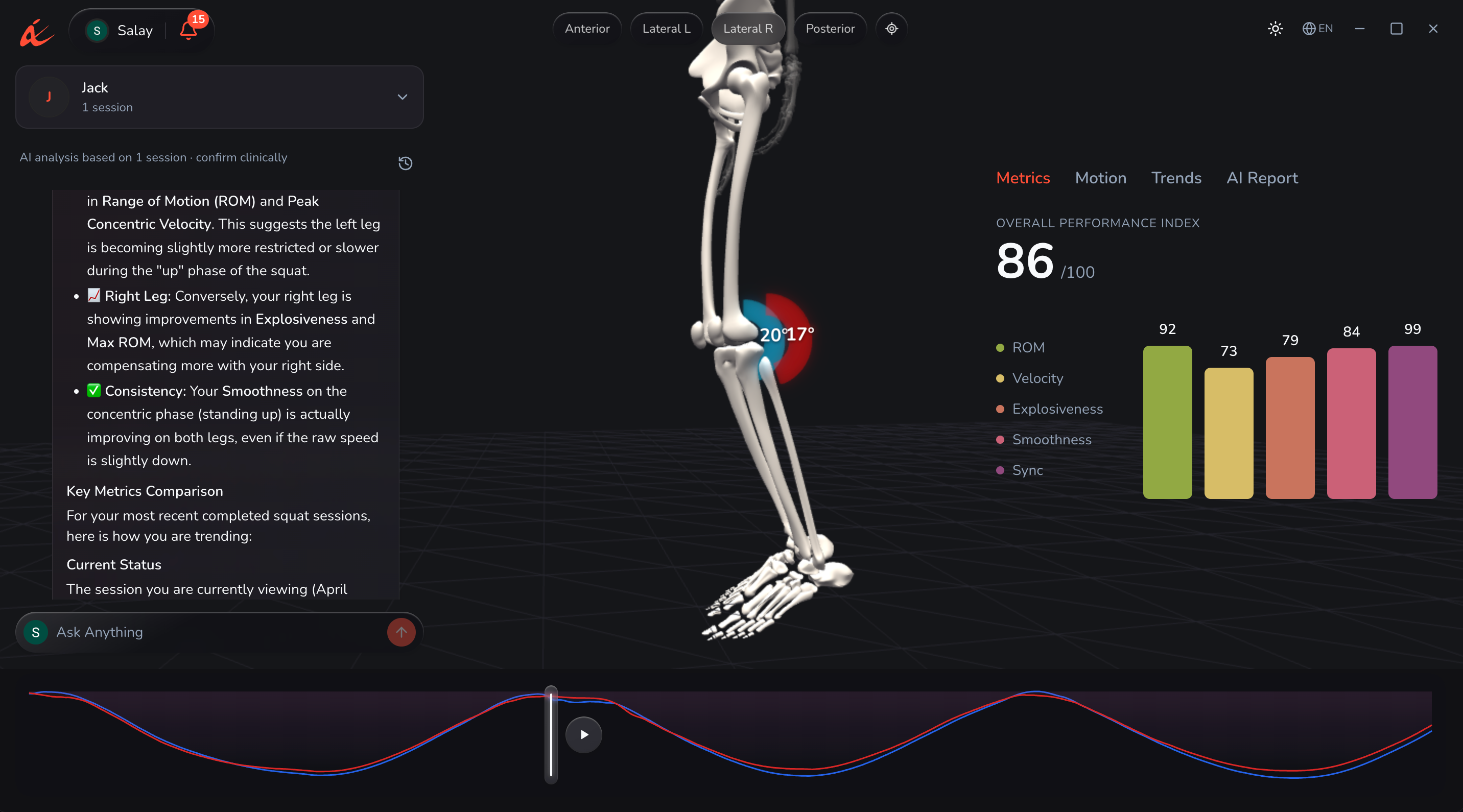 The TropX clinical dashboard: 3D skeleton, per-metric scores and an AI coach